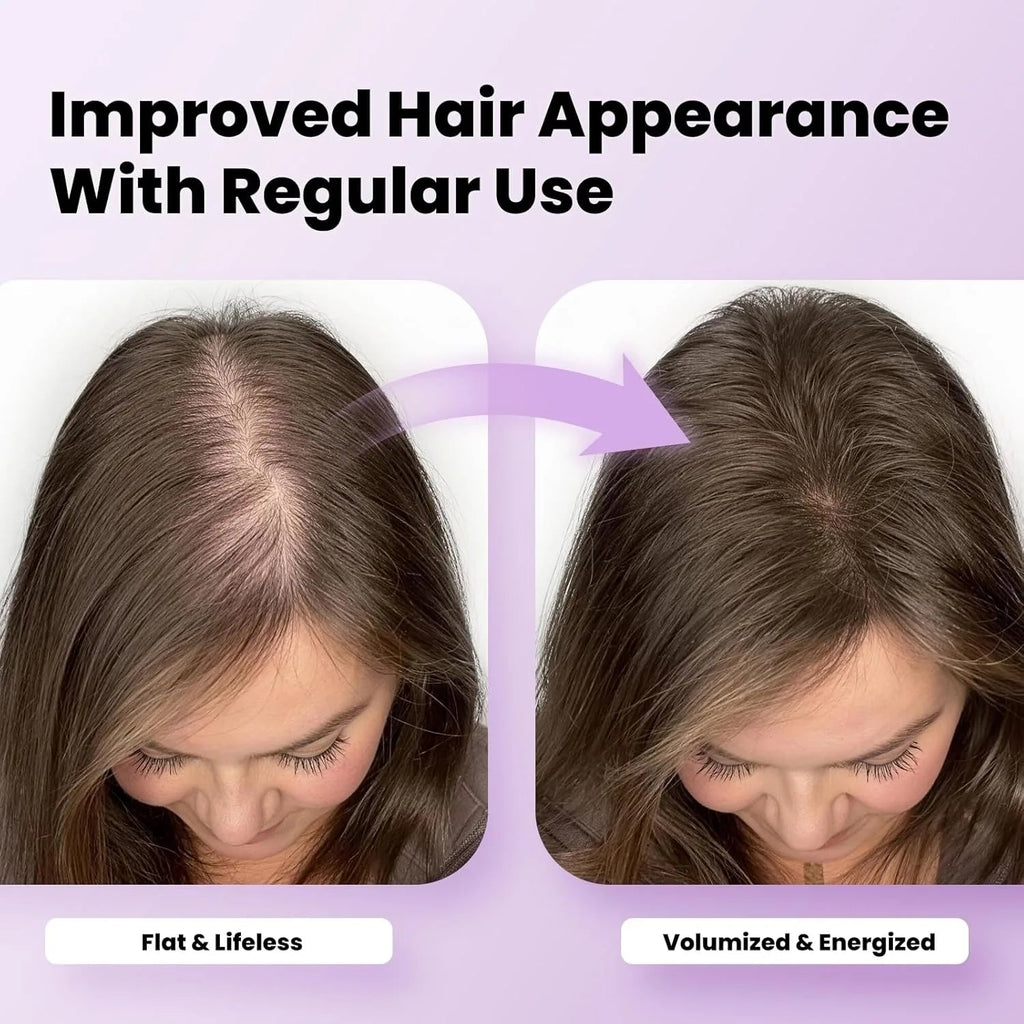120-LED Laser Helmet — Triple Wavelength Hair Restoration - Matos