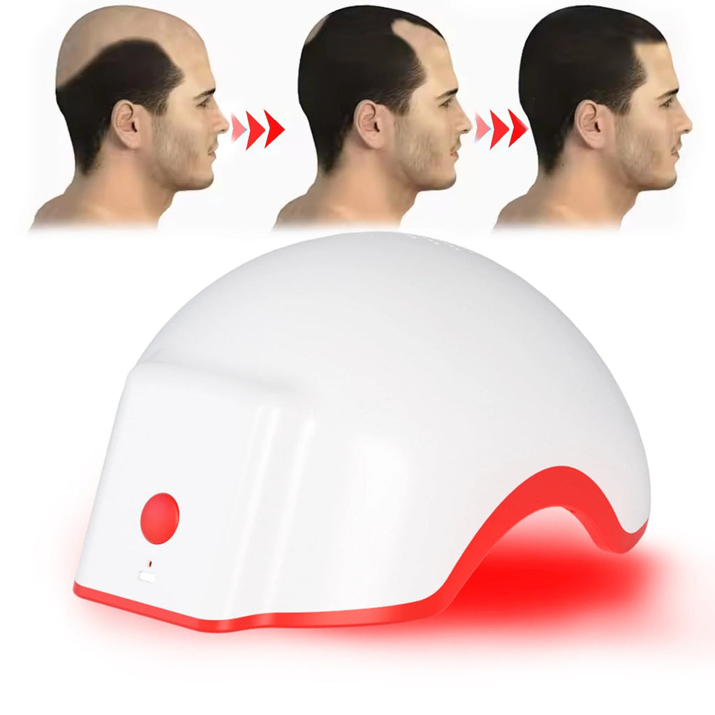 168-LED Red Light Helmet — Hair Regrowth & Scalp Stimulation - Matos