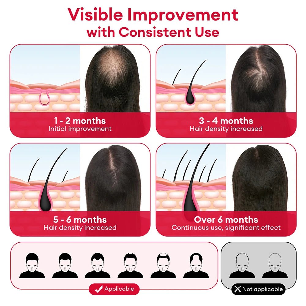 650nm+850nm LED Helmet — Restore Hair Thickness & Vitality - Matos
