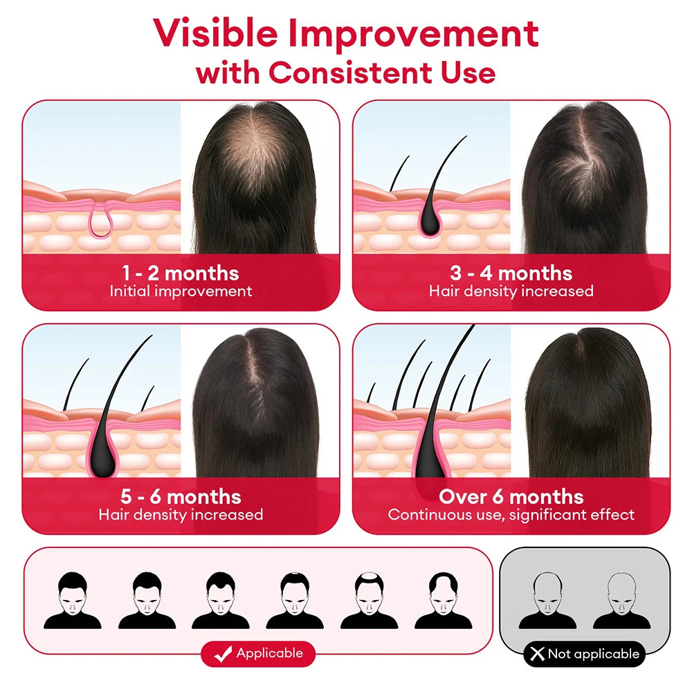650nm+850nm LED Helmet — Restore Hair Thickness & Vitality