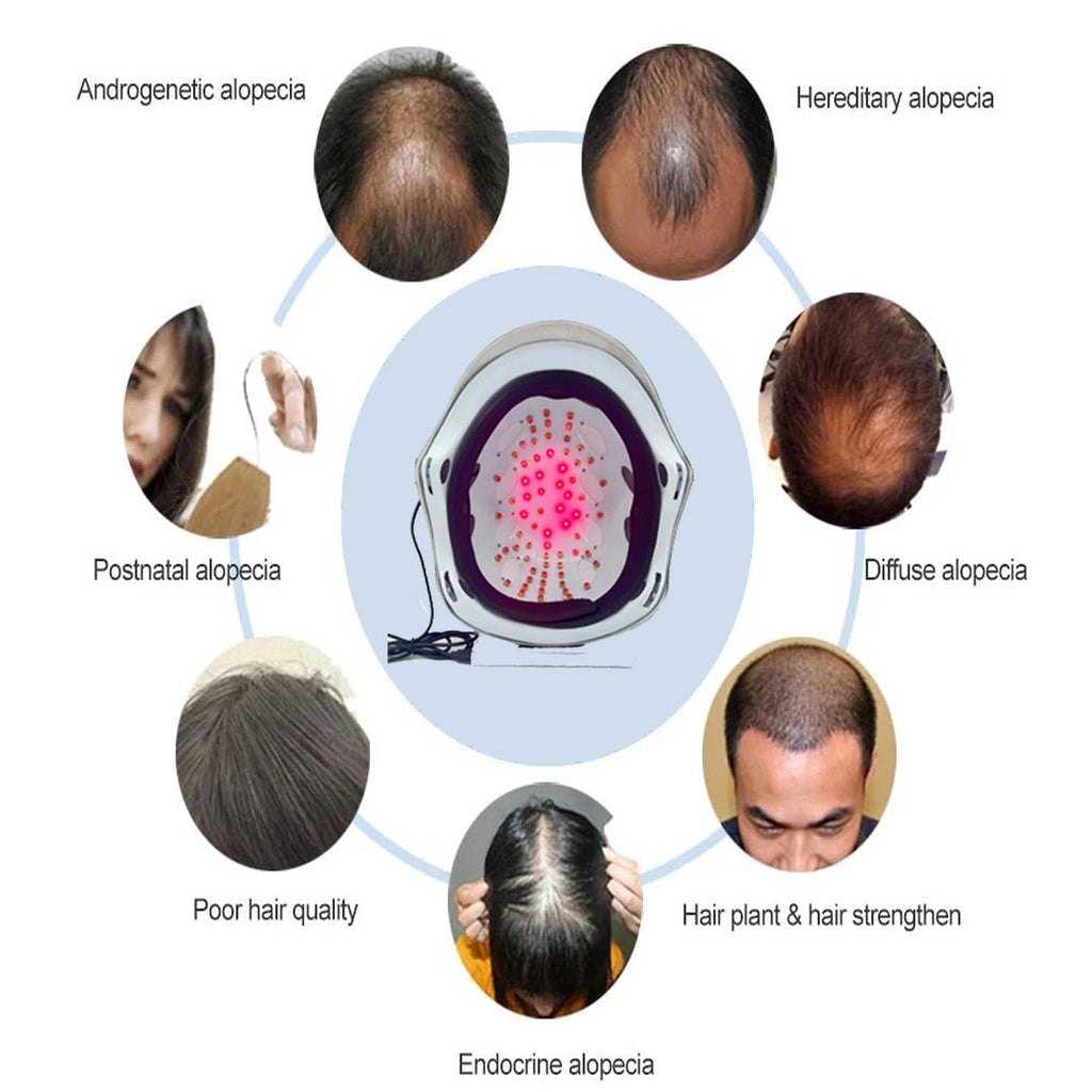 Laser Hair Growth Cap — Daily Anti-Hair Loss Treatment - Matos