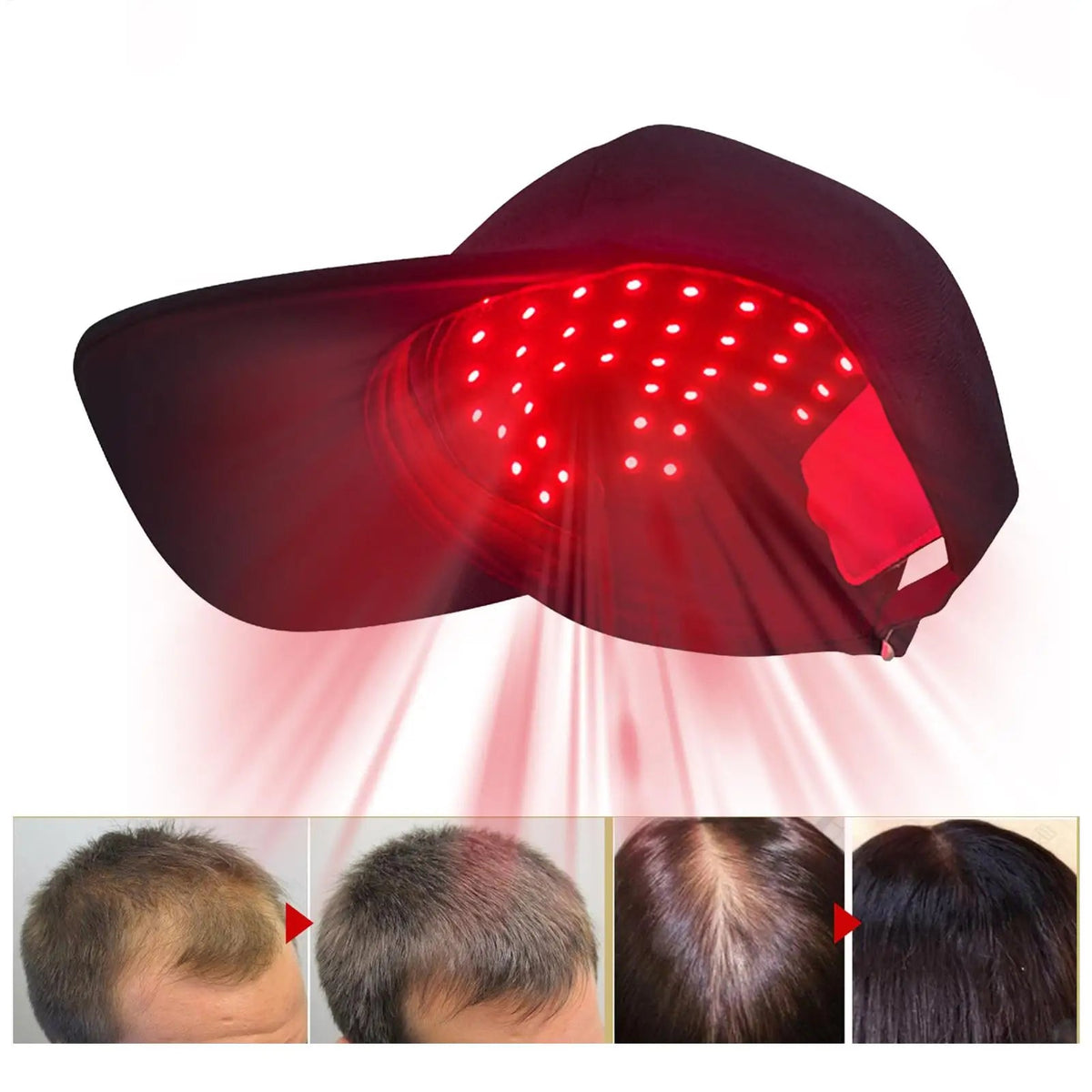 Premium Infrared Hair Cap — Intense Regrowth for Men & Women - Matos